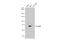 RELB Proto-Oncogene, NF-KB Subunit antibody, GTX102333, GeneTex, Western Blot image 