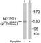 Protein Phosphatase 1 Regulatory Subunit 12A antibody, MBS000692, MyBioSource, Western Blot image 