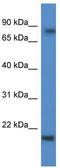 Keratin Associated Protein 1-5 antibody, TA342999, Origene, Western Blot image 