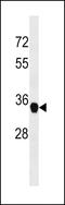 Zinc Finger C2HC-Type Containing 1A antibody, LS-C159602, Lifespan Biosciences, Western Blot image 