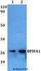 Protein Plunc antibody, A03162, Boster Biological Technology, Western Blot image 