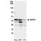 Nucleoporin 35 antibody, NB100-93322, Novus Biologicals, Western Blot image 