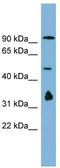 N(Alpha)-Acetyltransferase 35, NatC Auxiliary Subunit antibody, TA339365, Origene, Western Blot image 