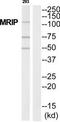 Myosin Phosphatase Rho Interacting Protein antibody, TA315225, Origene, Western Blot image 