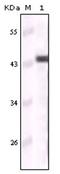 Keratin 5 antibody, AM06179SU-N, Origene, Western Blot image 