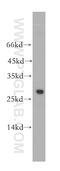 Ubiquitin Conjugating Enzyme E2 S antibody, 18219-1-AP, Proteintech Group, Western Blot image 