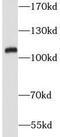 VPS18 Core Subunit Of CORVET And HOPS Complexes antibody, FNab09429, FineTest, Western Blot image 
