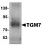 Transglutaminase 7 antibody, LS-B9576, Lifespan Biosciences, Western Blot image 