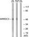 Arrestin Domain Containing 3 antibody, TA315672, Origene, Western Blot image 