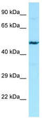 Heparanase 2 (Inactive) antibody, TA338291, Origene, Western Blot image 