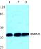 BCL2 Interacting Protein 2 antibody, PA5-75489, Invitrogen Antibodies, Western Blot image 