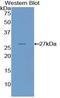 Nicotinamide N-Methyltransferase antibody, LS-C295630, Lifespan Biosciences, Western Blot image 