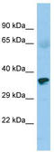 Zinc finger protein 330 antibody, TA331978, Origene, Western Blot image 