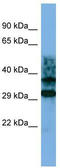 Crystallin Zeta Like 1 antibody, TA338954, Origene, Western Blot image 