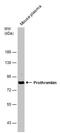 Coagulation Factor II, Thrombin antibody, PA5-77976, Invitrogen Antibodies, Western Blot image 