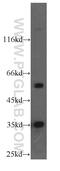 Lactate Dehydrogenase B antibody, 19988-1-AP, Proteintech Group, Western Blot image 