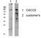 Potassium Voltage-Gated Channel Subfamily B Member 1 antibody, STJ99614, St John