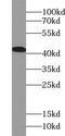 ACAT-2 antibody, FNab00073, FineTest, Western Blot image 