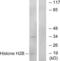 Histone H2B antibody, LS-B7677, Lifespan Biosciences, Western Blot image 