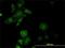 Prolyl 3-Hydroxylase 1 antibody, H00064175-M01, Novus Biologicals, Immunocytochemistry image 
