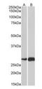 Activating Transcription Factor 5 antibody, orb18672, Biorbyt, Western Blot image 