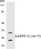Protein Phosphatase 1 Regulatory Inhibitor Subunit 1B antibody, EKC1165, Boster Biological Technology, Western Blot image 