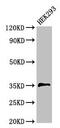 Palmitoyl-Protein Thioesterase 1 antibody, CSB-PA018587LA01HU, Cusabio, Western Blot image 