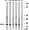 Neuromedin S antibody, GTX87519, GeneTex, Western Blot image 