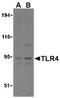 Toll Like Receptor 4 antibody, TA306126, Origene, Western Blot image 