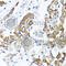 Protoporphyrinogen oxidase antibody, A6397, ABclonal Technology, Immunofluorescence image 