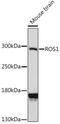 ROS Proto-Oncogene 1, Receptor Tyrosine Kinase antibody, GTX00638, GeneTex, Western Blot image 