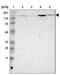 Mitogen-Activated Protein Kinase Kinase Kinase 9 antibody, NBP1-82781, Novus Biologicals, Western Blot image 