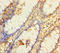 BRCA1/BRCA2-Containing Complex Subunit 3 antibody, A54460-100, Epigentek, Immunohistochemistry paraffin image 