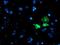 AP2M1 antibody, NBP2-00834, Novus Biologicals, Immunocytochemistry image 