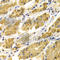 Phenylethanolamine N-Methyltransferase antibody, A5553, ABclonal Technology, Immunohistochemistry paraffin image 
