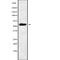 Phosphatidylinositol Glycan Anchor Biosynthesis Class W antibody, abx217769, Abbexa, Western Blot image 