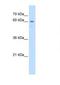 UNC Homeobox antibody, NBP1-91314, Novus Biologicals, Western Blot image 