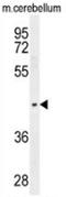 PTOV1 Extended AT-Hook Containing Adaptor Protein antibody, AP53508PU-N, Origene, Western Blot image 