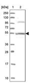 Scianna blood group antigen antibody, PA5-60029, Invitrogen Antibodies, Western Blot image 