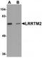 Leucine Rich Repeat Transmembrane Neuronal 2 antibody, TA319881, Origene, Western Blot image 