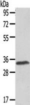 Uncoupling Protein 3 antibody, TA351891, Origene, Western Blot image 