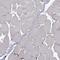 Phosphoglycerate Dehydrogenase antibody, HPA021241, Atlas Antibodies, Immunohistochemistry frozen image 
