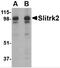 SLIT And NTRK Like Family Member 2 antibody, 4457, ProSci, Western Blot image 