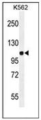 Jagged Canonical Notch Ligand 1 antibody, AP52261PU-N, Origene, Western Blot image 