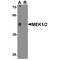 Mitogen-Activated Protein Kinase Kinase 1 antibody, TA349182, Origene, Western Blot image 