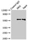 ETS Transcription Factor ERG antibody, orb23876, Biorbyt, Immunoprecipitation image 
