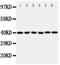 Cellular Communication Network Factor 4 antibody, PA5-80228, Invitrogen Antibodies, Western Blot image 