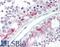 Zinc Finger DHHC-Type Containing 17 antibody, 45-728, ProSci, Enzyme Linked Immunosorbent Assay image 