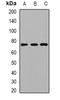 Peroxisomal acyl-coenzyme A oxidase 1 antibody, orb341430, Biorbyt, Western Blot image 