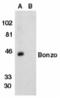 C-X-C Motif Chemokine Receptor 6 antibody, TA306016, Origene, Western Blot image 